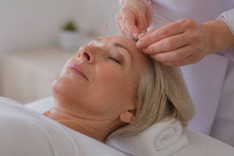 Bienfait acupuncture : effets, indications et précautions pour les seniors